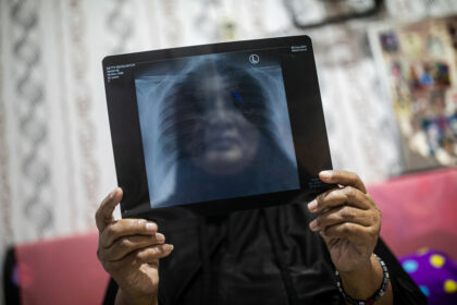 3cc95790 75b4 4bcf b773 6eabc42ee10d