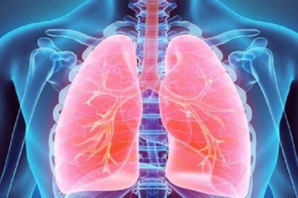 Juru Bicara Kementerian Kesehatan RI dr. Mohammad Syahril mengatakan pendeteksian tertinggi penyakit TBC berkat adanya komitmen dari pemerintah dan surveilans yang semakin gencar. Foto: healthvision.in