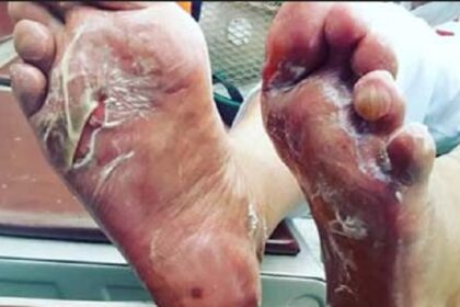 Jamaah haji harus mewaspadai cuaca panas di Madinah. Foto: Kemenkes