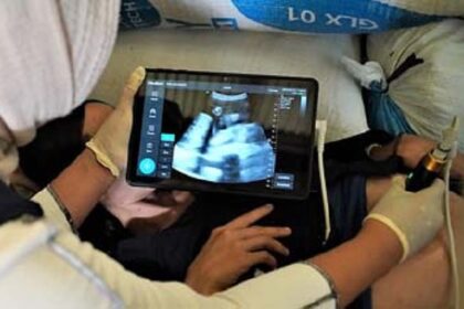 Bulan Oktober 2022, puskesmas Cisimeut mendapatkan USG portable dari RS Universitas Indonesia, USG portable ini digunakan untuk pemeriksaan di Posyandu. Sementara USG di Puskesmas Cisimeut pada awal 2023 didapatkan dari Dinas Kesehatan Lebak.