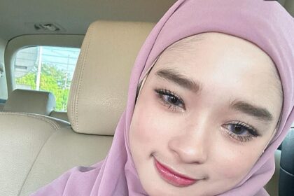 Inara Rusli kecelakaan saat live, Foto : Instagram, @mommy_starla