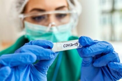 Pemerintah Indonesia mengantisipasi penyebaran virus COVID-19 yang merebak di Singapura. Foto: Kemenkes