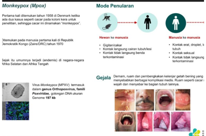 Plh. Direktur Jenderal Pencegahan dan Pengendalian Penyakit Kemenkes, dr Yudhi Pramono, mengimbau masyarakat agar tetap mewaspadai penularan virus Mpox. Foto: Kemenkes