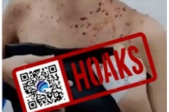 Beredar video pendek hoax munculnya virus Mpox di Pulau Bali. Foto: Ist