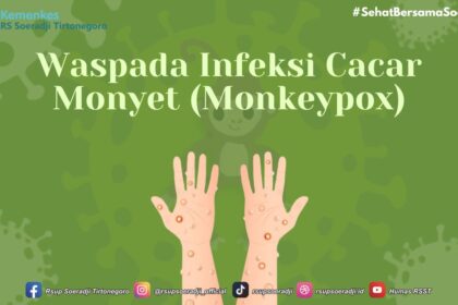 monkeypox