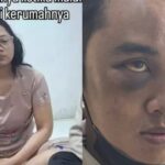 Viral ASN di Kabupaten Bandung Barat (KBB) Calvin Chandra yang jadi korban KDRT sang istri. Foto: IG @adityaarthaz