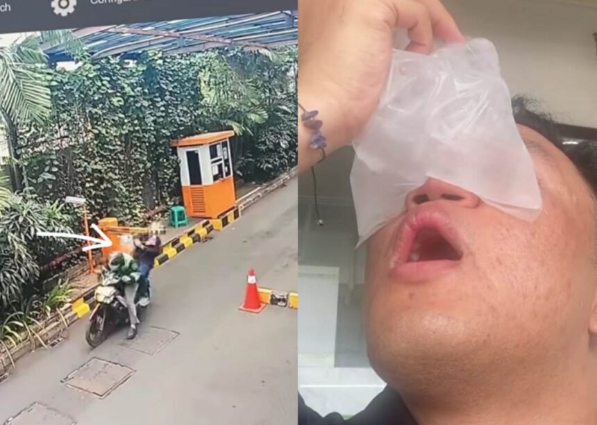 Penumpang ojol terkena palang parkir otomatis karena pengemudi terobos palang parkir. Foto: Tangkapan layar Instagram @michaelangelomanurung