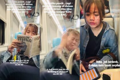 Widya Anggraini menjadi korban pelemparan batu di Kereta Sancaka Yogya-Surabaya menyebabkan muka dan matanya terkena serpihan kaca. Foto: Tangkap layar IG @widya_anggraini_awaw