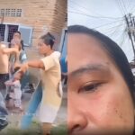 Petugas koperasi, Michelle Natalie Angle Gultom, mengalami luka memar di wajah usai dianiaya oleh nasabah saat menagih utang di Jalan Rakyat, Kecamatan Medan Perjuangan, Kota Medan, Kamis (6/11/2025). Foto: Tangkap layar TikTok @monopoli_news