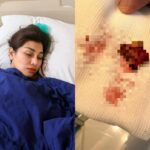 Nissya Ahmad menjalani pemulihan di rumah sakit setelah operasi benjolan di kepala yang berjalan lancar. Foto: IG @raffinagita1717