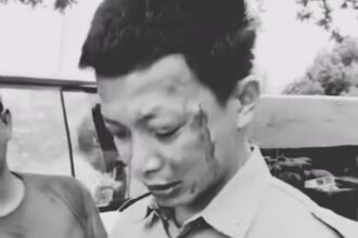 Sopir ambulans Muhammad Syamsudin diduga menjadi korban pengeroyokan saat mengantar pasien di Bengalon, Kutai Timur, Selasa (6/1/2026). Foto: IG @merindink_kaltim