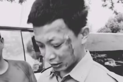 Sopir ambulans Muhammad Syamsudin diduga menjadi korban pengeroyokan saat mengantar pasien di Bengalon, Kutai Timur, Selasa (6/1/2026). Foto: IG @merindink_kaltim
