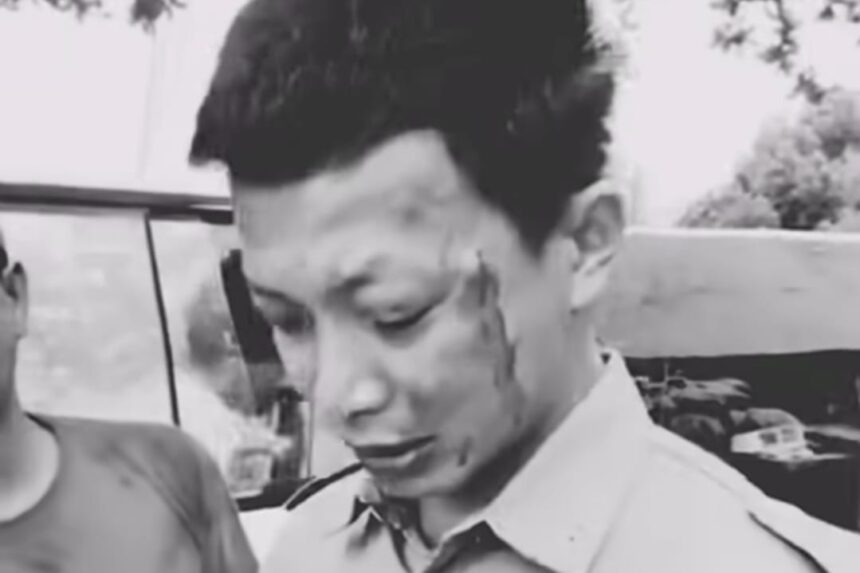 Sopir ambulans Muhammad Syamsudin diduga menjadi korban pengeroyokan saat mengantar pasien di Bengalon, Kutai Timur, Selasa (6/1/2026). Foto: IG @merindink_kaltim