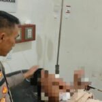 Seorang siswa SMP berinisial V mengalami luka tusuk usai diduga diserang teman sekolahnya sendiri menggunakan pisau. Foto: Instagram @lampunggehnews