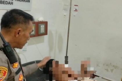 Seorang siswa SMP berinisial V mengalami luka tusuk usai diduga diserang teman sekolahnya sendiri menggunakan pisau. Foto: Instagram @lampunggehnews