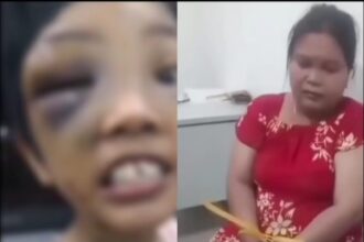 Polisi menetapkan VJ sebagai tersangka korban dugaan penganiayaan anak tirinya. Foto: Instagram @medsoszen