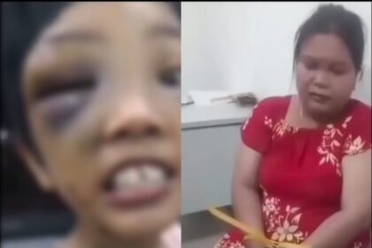 Polisi menetapkan VJ sebagai tersangka korban dugaan penganiayaan anak tirinya. Foto: Instagram @medsoszen