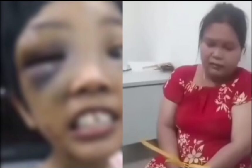 Polisi menetapkan VJ sebagai tersangka korban dugaan penganiayaan anak tirinya. Foto: Instagram @medsoszen